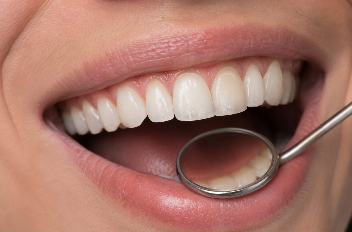 Detalle de tratamiento dental